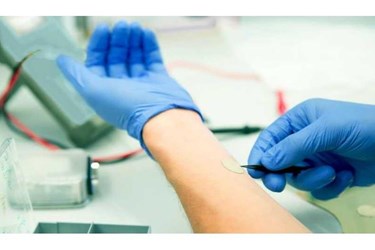 Two spin-off founders to industrialise adhesive health-monitoring electrode